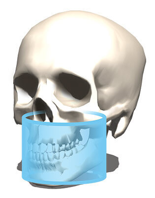 Tomograf KAVO OP 3D Pro