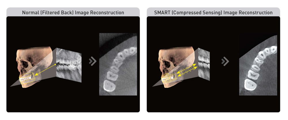 Tomograf Vatech PAXi 3D Smart
